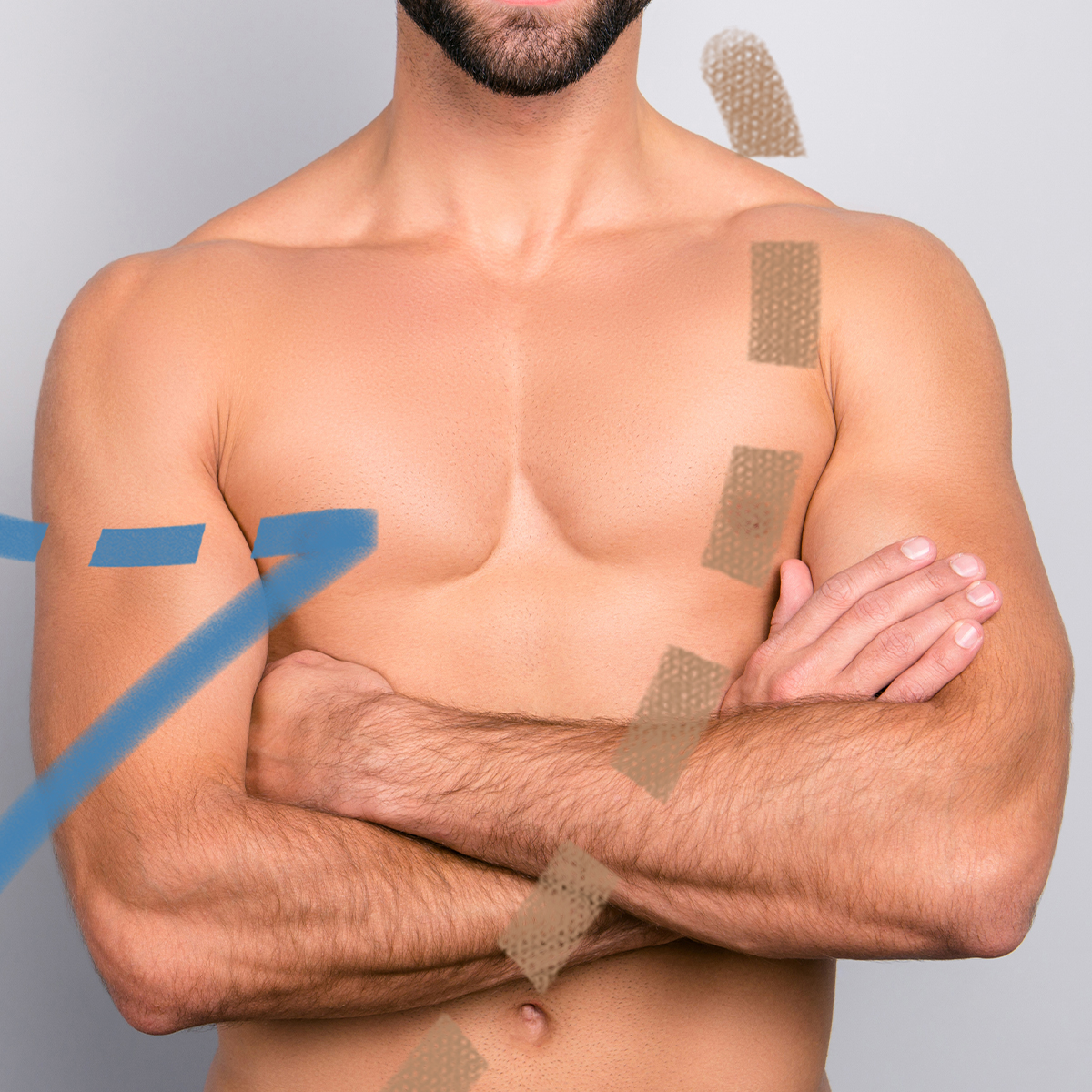 Gynekomastie v Perfect Clinic. Chirurgické odstranění mužské prsní žlázy. Svěřte se do rukou odborníků z Perfect Clinic, kteří vám pomohou problém vyřešit.