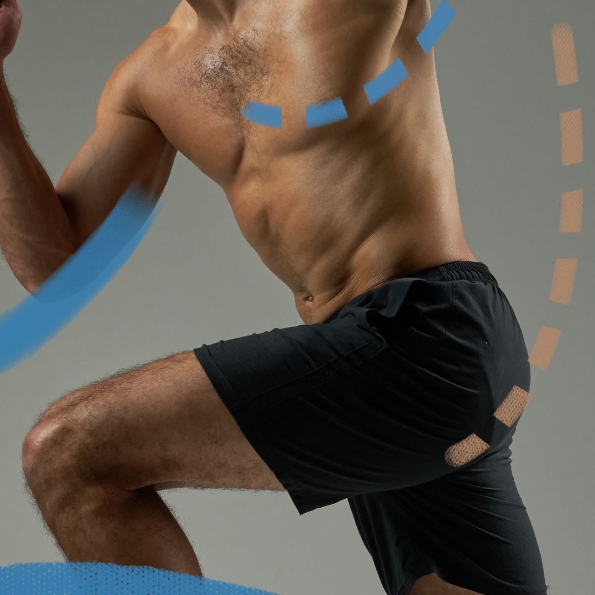 Intimní zákroky – muži, Perfect Clinic