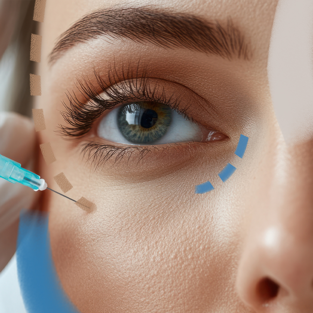 Odstranění kruhů pod očima Zbavte se tmavých kruhů v Perfect Clinic. Svěřte se do péče odborníků Perfect Clinic · Dermatology