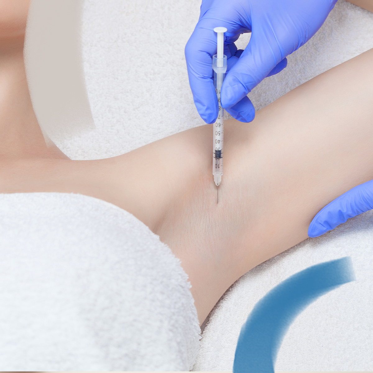 Odstranění nadměrného pocení