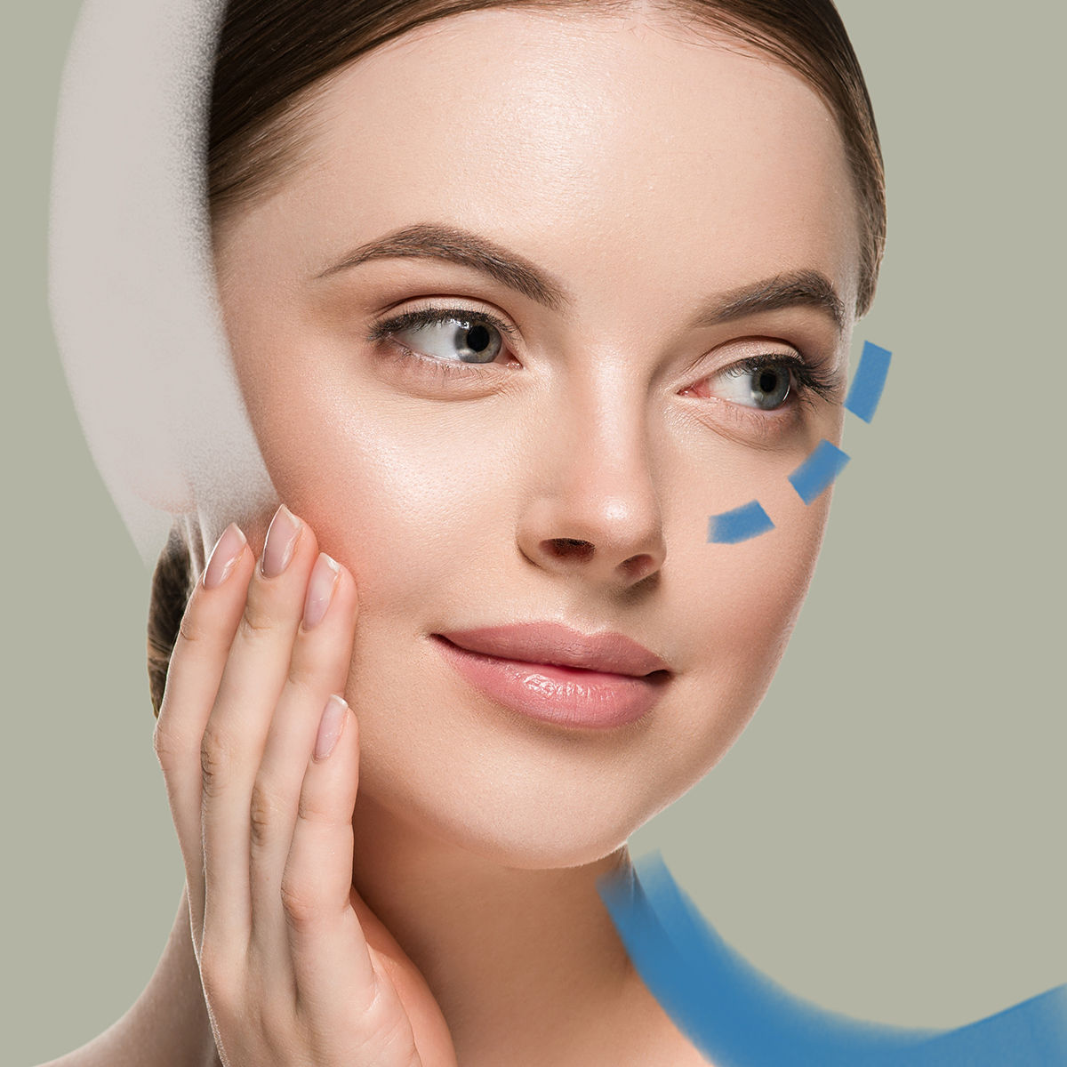 Septo-rhinoplastika Kombinace estetické a funkční operace nosu v Perfect Clinic