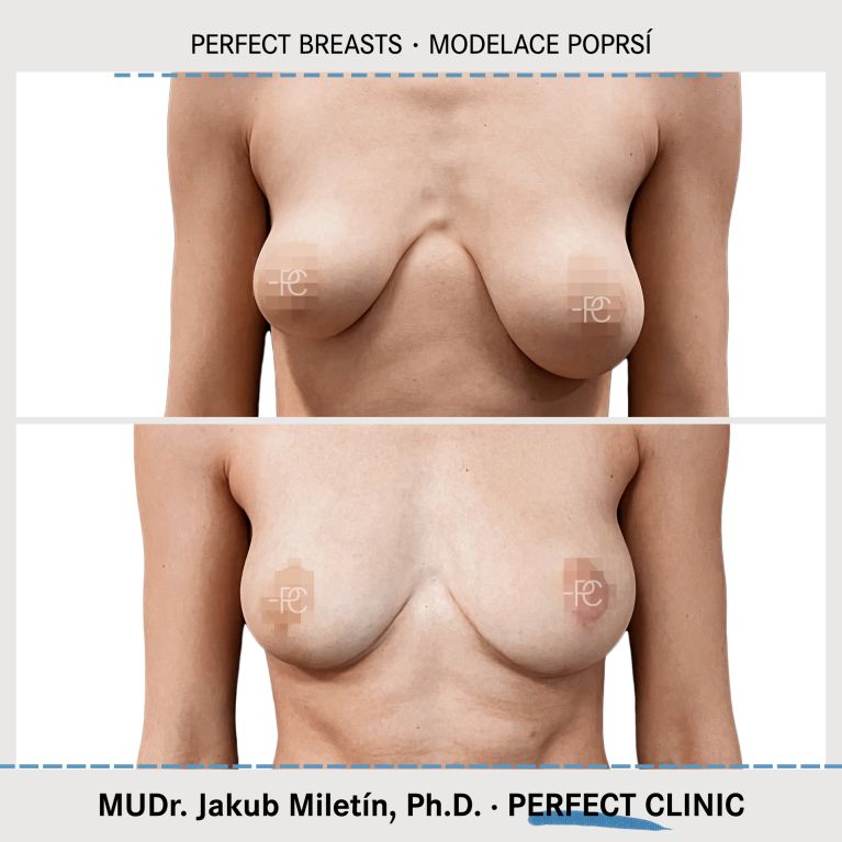 Modelace prsou