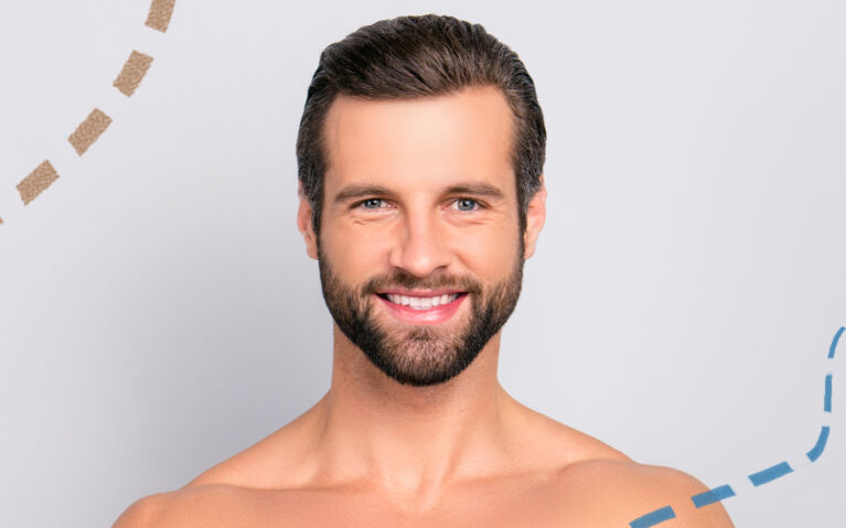 Vypadávání vlasů