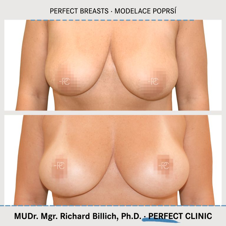 Modelace poprsí
